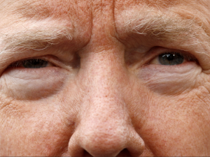 closeup view of Trump's eyes and nose